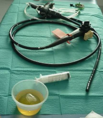 endoscope